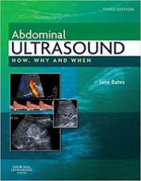 Image of Abdominal Ultrasound How, Why and When