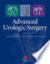 Image of Advanced Urologic Surgery