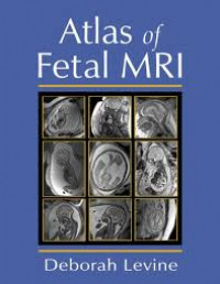 Image of Atlas of Fetal MRI