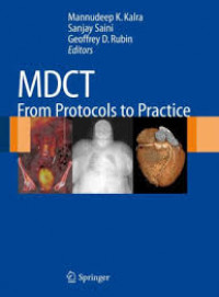 Image of MDCT from Protocols to Practice