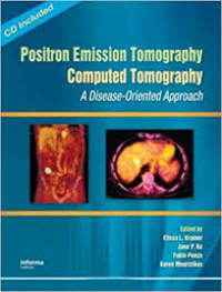 Image of Positron Emission Tomography Computed Tomography: a disease- oriented approach