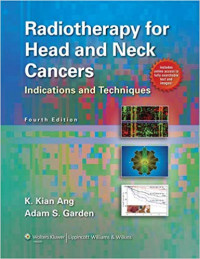 Image of Radiotherapy for Head and Neck Cancers: Indications and Techniques