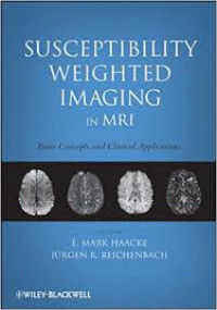 Image of Susceptibility Weighted Imaging in MRI: basic concepts and clinical applications