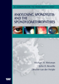 Image of Ankylosing Spondylitis and the Spondyloarthropathies
