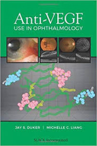 Image of Anti-VEGF use in Ophthalmology