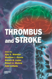 Image of Thrombus and Stroke