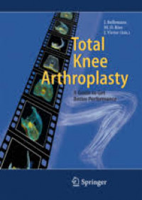 Image of Total Knee Arthroplasty: a guide to get better performance