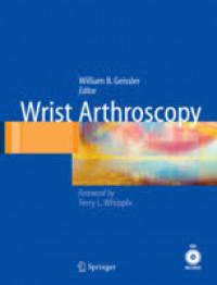 Image of Wrist Arthroscopy